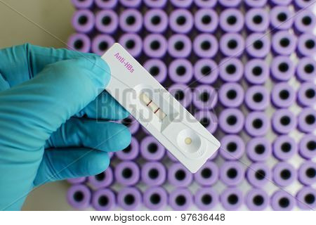 Anti-HBs positive