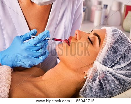 Filler injection for female forehead face. Plastic aesthetic facial surgery in beauty clinic. Silicone lips in the girl. Doctor in medical gloves with syringe injects lips augmentation.