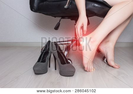 A Girl Sits In An Office Chair And Smears A Foot Ointment With Medical Ointment Against A Fungal Inf