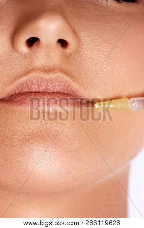 Closeup Of Procedure To Lip Augmentation. Beautiful Young Woman Mouth Receiving Hyaluronic Acid Inje