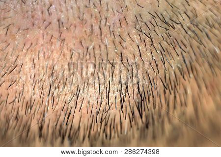 Male Stubble Close-up - Short Hair Beard, Macro