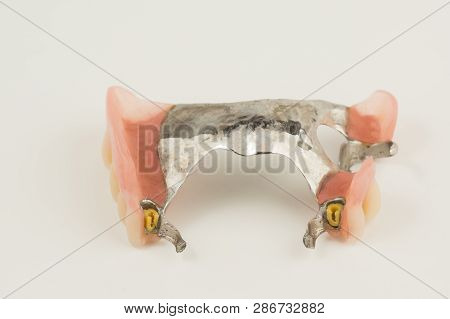 Bugel Remove Dentures With Attachments On White Background
