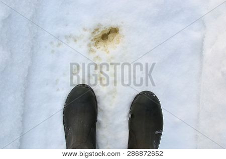 A Man Pisses On The White Snow. Copy Space, Prostatitis, Urolithiasis, Urination Disorder Concept