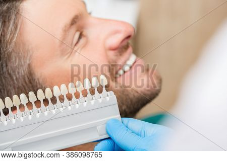 Dentist Uses A Palette Tooth Color Sample To Determine Shade Of Patients Male Teeth. Stomatologist W