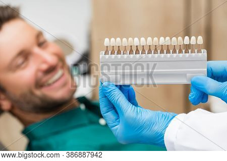 Palette Tooth Color Sample To Determine Shade Over Patients Teeth. Stomatologist Will Uses Color Of 
