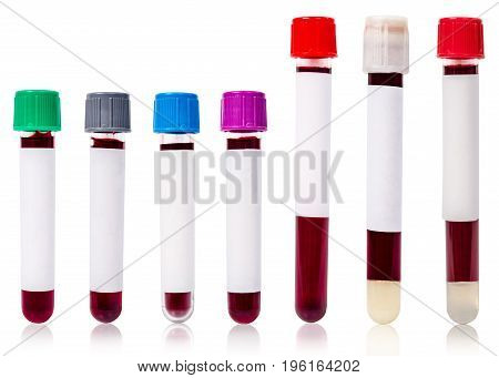 collection blood tube. Different color and size of blood tube with sample blood for test isolated on white background.