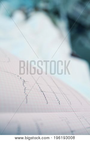 ECG chart on the background of hospital ward.