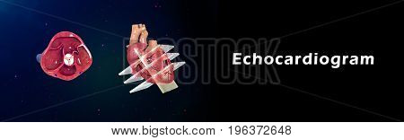 An echocardiogram (also called an echo) is a type of ultrasound test that uses high-pitched sound waves that are sent through a device called a transducer.