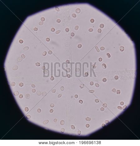 Fresh red blood cells in urine sample shooting with microscope.