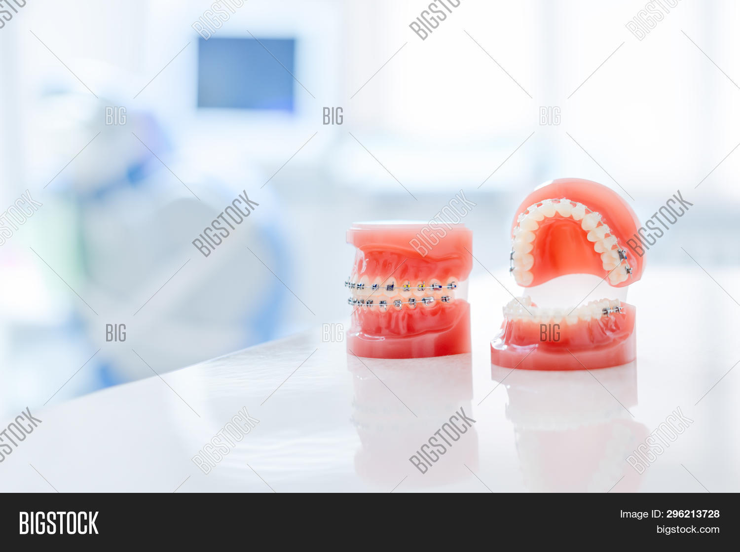 Orthodontic Model Image & Photo (Free Trial) Bigstock