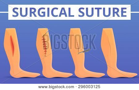 Medical Suture Concept Background. Cartoon Illustration Of Medical Suture Vector Concept Background 