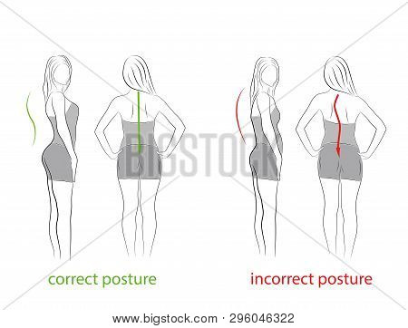 Correct Alignment Of Human Body In Standing Posture For Good Personality And Healthy Of Spine And Bo
