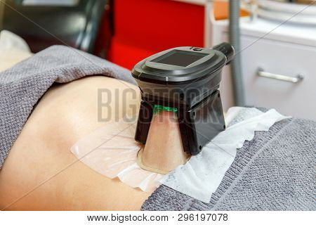 Cryolipolysis Freeze Fat Procedure In Cosmetic Cabinet Or Spa Salon, Belly Close-up