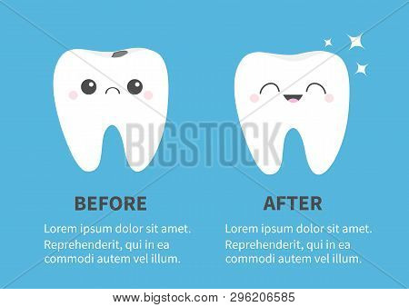 Tooth Icon Set. Before After Infographic Template. Shining Star. Healthy Smiling Crying Bad Ill Teet