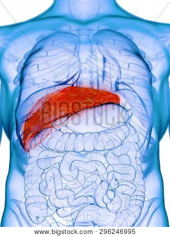 3d rendered medically accurate illustration of a diseased liver