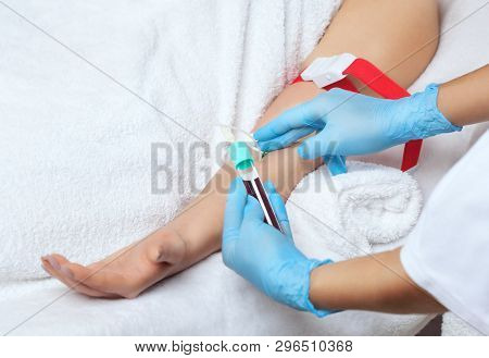 The Procedure For Taking Blood From A Vein To Separate Blood Plasma In A Centrifuge.prp Procedure