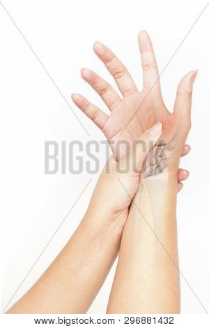 Hand Bones Injury White Background Hand Pain