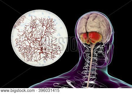 Human Brain With Highlighted Cerebellum And Close-up View Of Purkinje Neurons, One Of The Commonest 