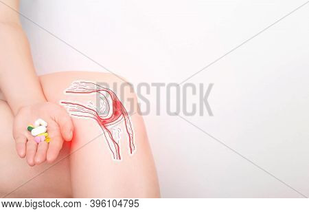 The Girl Holds A Handful Of Pills In Her Hand For Pain In The Knee Joint. Concept Of Drugs For The T