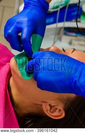 Installation Of A Rubber Dam With A Metal Clamp For Dental Fillings, Sterile And Modern Dental Treat