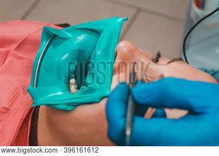Dentist Treats The Tooth With Modern Methods, Uses A Rubber Dam, Sterile Tooth Treatment.