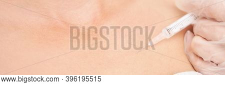 Near Eye Injection At Spa Salon. Doctor Hands. Closeup. High Quality. Pretty Female Patient. Beauty 