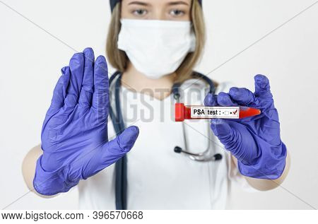 Medicine And Health Concept. The Doctor Holds In His Hands A Test Tube With Blood Tests For The Psa,