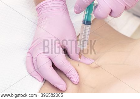 Lipolytic Injections Are Placed In The Stomach. Female Hands In Pink Gloves Inject A Young Woman Int