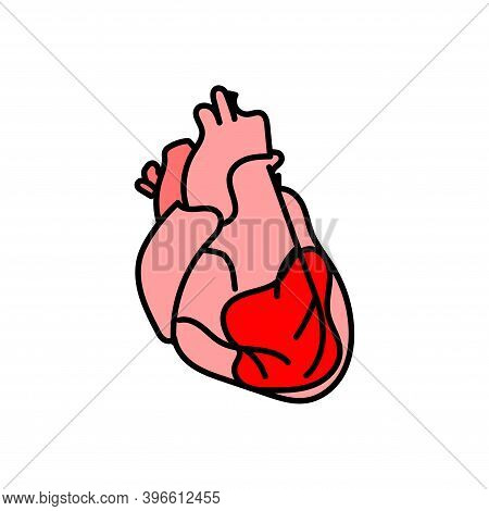Human Heart Icon, Stroke, Myocardial Infarction, Bleeding, Infection, Pericarditis, Red Spot, Vector