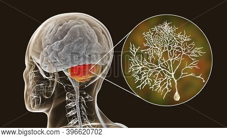Human Brain With Highlighted Cerebellum And Close-up View Of Purkinje Neurons, One Of The Commonest 