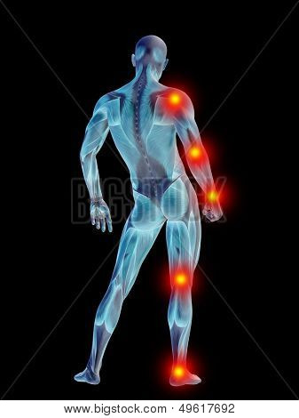 High resolution concept or conceptual 3D human anatomy body with pain isolated on black background as a metaphor to health,medicine,medical,biology,osteoporosis,arthritis,joint,inflammation or ache