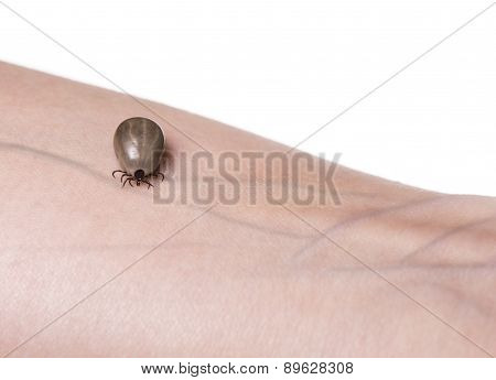 Tick On A Skin