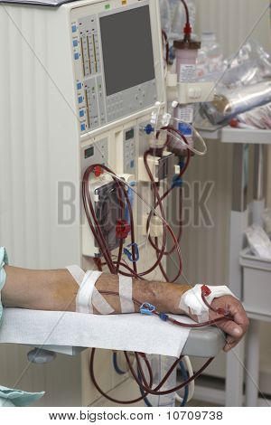 Dialyse Health Care Geneeskunde nier
