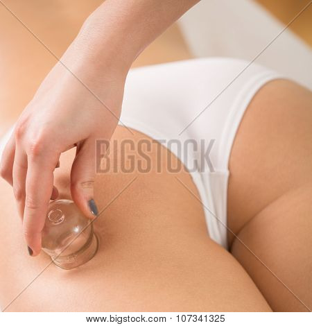 Beautician Using Chinese Cupping