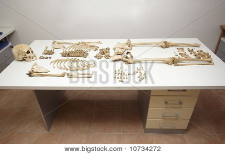 Kostry lebky, Bones