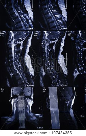 Mri Scan