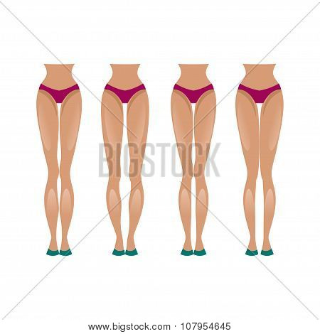 Slender And Crooked Legs. Vector Illustration