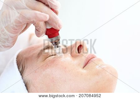 Needle Mesotherapy, face lift. Beautician performs a needle mesotherapy treatment on a woman's face