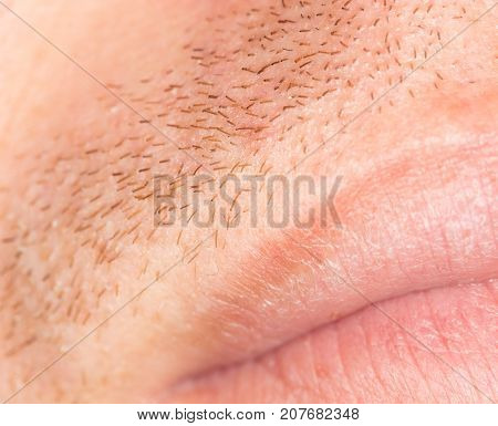 bristles on the skin. close-up . Photo of abstract background