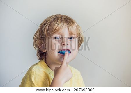 Three-year Old Boy Shows Myofunctional Trainer To Illuminate Mouth Breathing Habit. Helps Equalize T