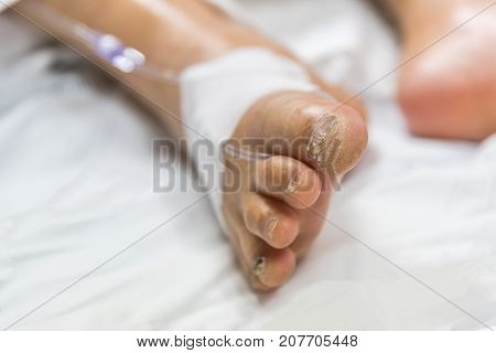 Patient In The Hospital With Saline Intravenous