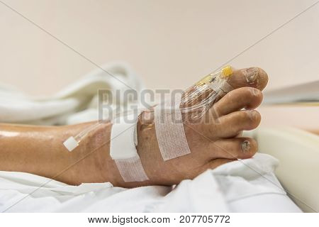 Patient In The Hospital With Saline Intravenous