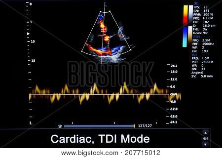 Colourful Image Of Homan Heart Ultrasound Monitor
