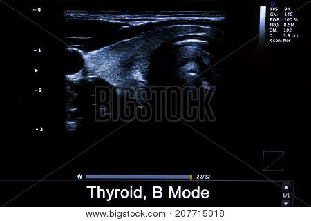 Colourful Image Of Modern Ultrasound Monitor