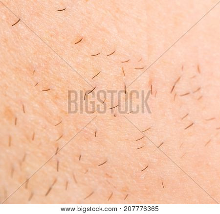 bristles on the skin. close-up . Photo of abstract background