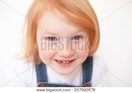 Beautiful red-haired girl with freckles and caries
