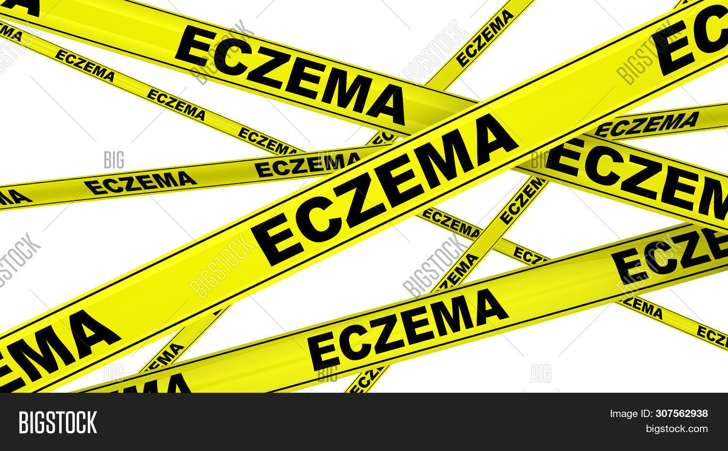 Eczema. Yellow Warning Image & Photo (Free Trial) Bigstock