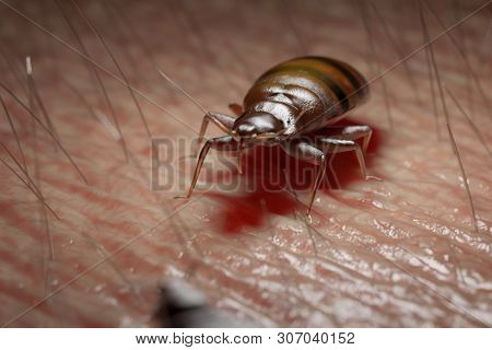 3d rendered medically accurate illustration of a bed bug on human skin