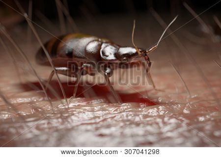 3d rendered medically accurate illustration of a bed bug on human skin