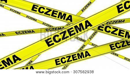Eczema. Yellow Warning Tapes With Black Words Eczema (eczema Is A Group Of Diseases That Results In 